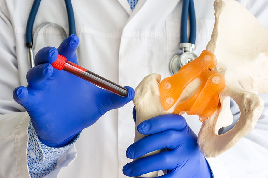 Bone marrow aspirate concentrate is a treatment for musculoskeletal injuries and degenerative joint conditions that have not responded to conservative care.