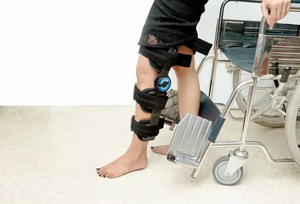 A patient wearing a knee brace steps away from a wheelchair, part of early rehabilitation while an ACL graft heals into the bon